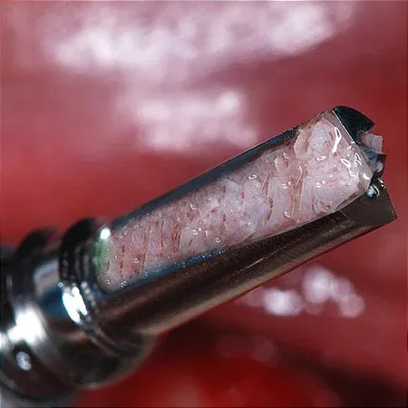 Broca Coletora com Capa - 7,0mm 3