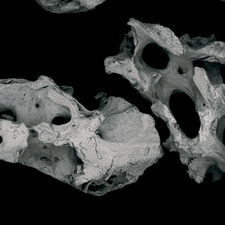 Enxerto Ósseo Bovino Bonefil Mix Médio [0,60-1,50 mm] 4