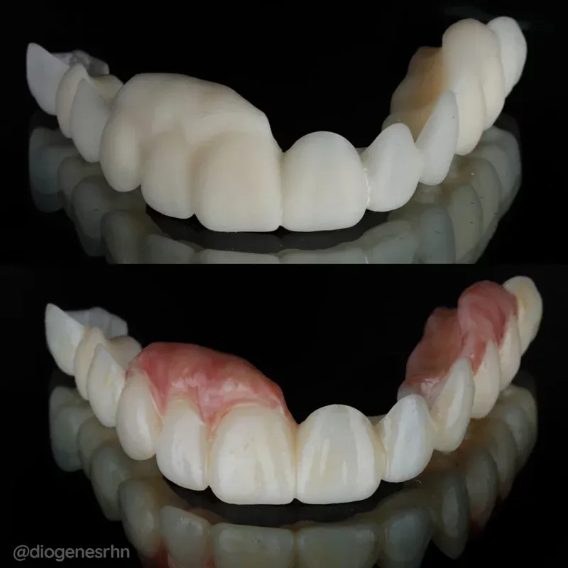 Resina priZma 3D Bio Prov Provisórios A2 2