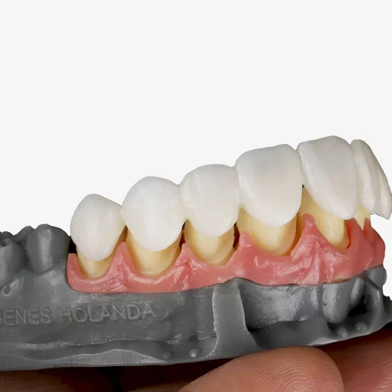 Resina priZma 3D Bio Prov Provisórios A2 3